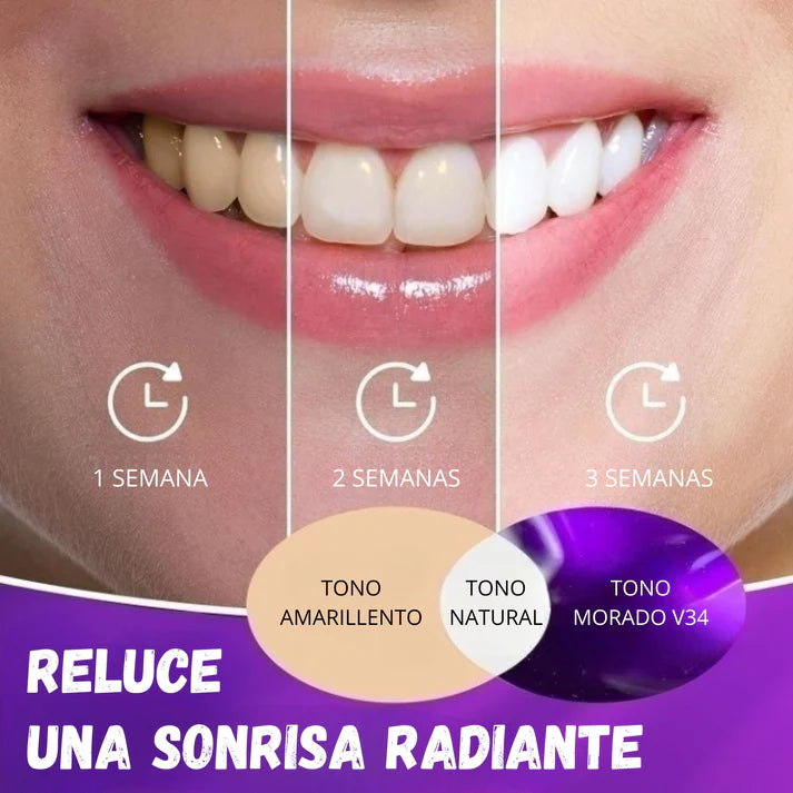 Di adiós a los dientes amarillos con SmileKit