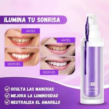 Di adiós a los dientes amarillos con SmileKit